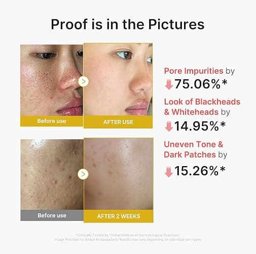 medicube Peel Shot with Turmeric | Reset in One Step | Gentle Exfoliating Serum with BHA, LHA & PHA for Dead Skin Cells, Blackheads & Excess Sebum | For Dull, Rough & Troubled Skin | 2.7 fl.oz thumbnail 4