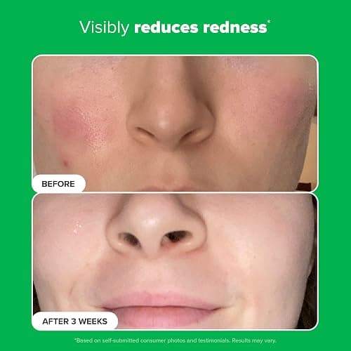 Paula's Choice BOOST 10% Azelaic Acid Booster Cream Gel Face Serum with Salicylic Acid, Oil-Free Skin Brightening Serum for Face, Fragrance-Free - 1 Ounce (Pack of 1) thumbnail 6