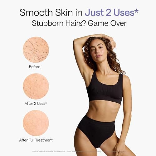 Ulike Laser Hair Removal Device Air 10 Ipl Gift for Women and Men, Ice Cool and Permanent Hair Reduction for Nearly Painless, Dual Lights, Skin Sensor & USHR Mode Hair Removal in 10mins from Home thumbnail 4