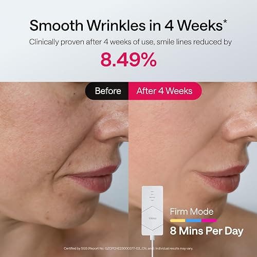 Ulike Light Therapy Mask($100 off coupon) thumbnail 6