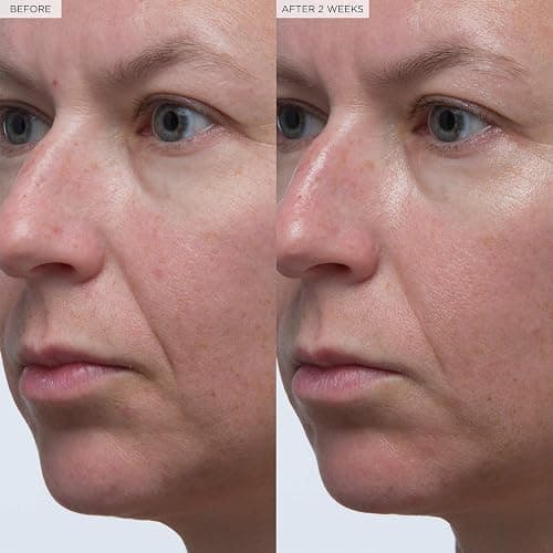Glow Recipe Plum Plump Hyaluronsäure-Hautpflege-Serum – feuchtigkeitsspendende Hautpflege + Gesichtsserum für Frauen und Männer mit antioxidativer Pflaume + Vitamin B5 zur Reparatur der Hautbarriere thumbnail 9