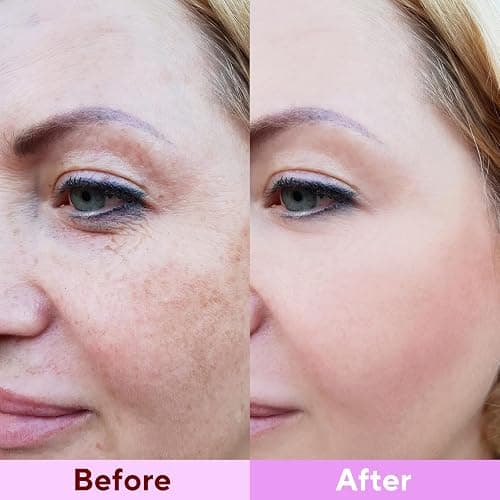 Nityrliv Collagen Face Mask, 4 Pack Bio-Collagen Real Deep Mask Overnight Hydrating Face Mask for All Skin Types,Original Hydrating Collagen Face Mask thumbnail 7