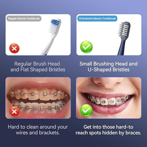 JTF Orthodontic Electric Toothbrush for Braces: 6 U-Shaped Soft Brush Heads, 5 Brushing Mode, 2Min Timer, IPX7 Waterproof, Deep Oral Clean, Rechargeable Sonic Toothbrushes for Tooth with Dental Device thumbnail 7