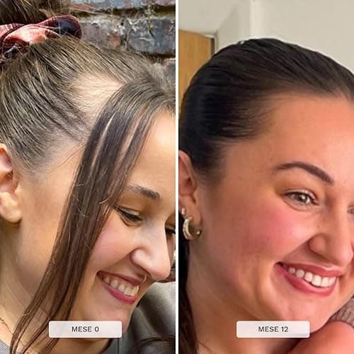 HAIR BURST Shampoo e Balsamo Set per la Crescita dei Capelli per le Donne Contro la Caduta e il Diradamento - Aumento della Crescita dei Capelli Sani thumbnail 6