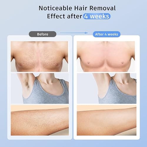 Laser Hair Removal Ubroo IPL Hair Removal Device with 5℃ Ice Cooling, 3 In 1 Painless Hair Removal For Women Men Permanent Face Body Beauty Care (Gold) thumbnail 7