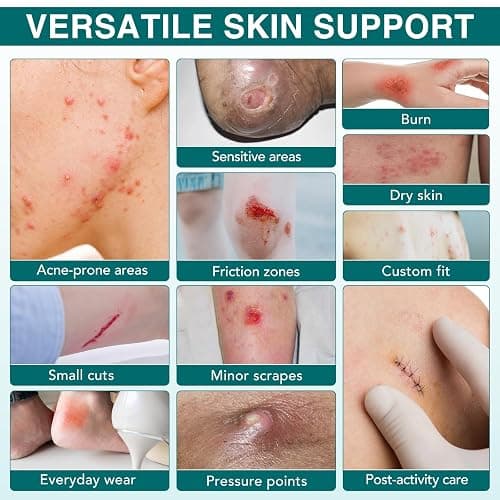 Hydrocolloid Roll for Wound Care, (2in*11.8ft) Hydrocolloid Bandages, Cut-to-Size, Medical Grade Hydrocolloid Roll with Self-Adhesive, Ultra Absorbent, Flexible & Waterproof, First Aid Kit Essential thumbnail 3