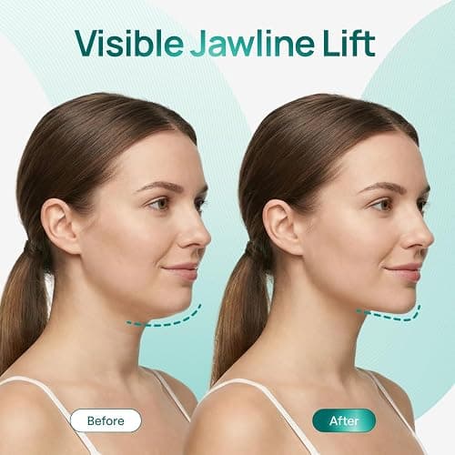Plantifique V-Line Face Mask with Hyaluronic Acid, 5 Pack Chin Strap for Double Chin, V Line Lifting Masks - V Shape Face Tape, Jawline & Neck Mask for Skin Firming thumbnail 2