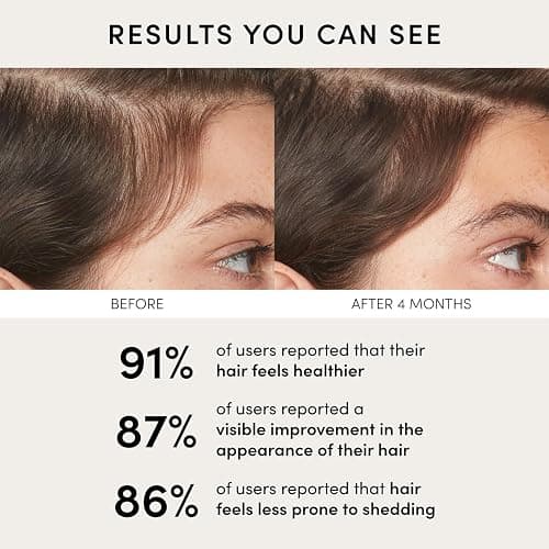 OUAI Scalp Serum - Balancing Hair Serum with Red Clover Extract, Siberian Ginseng and Peptides for Thicker and Fuller-Looking Hair - Paraben, Phthalate and Sulfate Free Scalp Care (2 Fl Oz) thumbnail 5