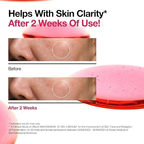 ANUA 10% Niacinamid + 4% TXA Serum, Ceramid, Hyaluronsäure, Vitamin B12, Tranexamic Acid, natürliche Farbe, koreanische Glashaut, parfümfrei, Dark Spot Serum, Korean Skincare, 30 ml thumbnail 6