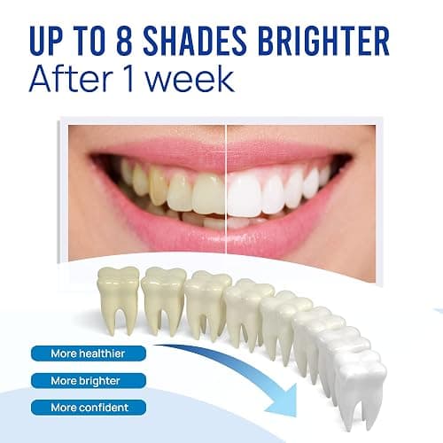 VieBeauti Teeth Whitening Pen Gel: 30+ Uses - Teeth whitening Gel with Professional Formulation and Ingredients, No Sensitivity, Travel-Friendly, Beautiful White Smile Mint thumbnail 2