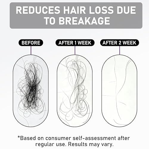 Hair Thickening Serum for Hair Loss, Korean Hair Growth Serum Roll On for Men and Women, Clinically Tested Rosemary Hair Growth Oil for Thinning Hair, Scalp Treatment, 0.5 Fl Oz thumbnail 2
