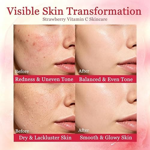 6 Pcs Strawberry Skincare Set for Teens Girls,Gentle Moisturizing Cleansing | Facial Cleanser for Girls 10-12,Daily Skin Care Routine Kit,Teen Girl Gifts Trendy Stuff,Birthday Gifts,Spa day kit for Women thumbnail 4