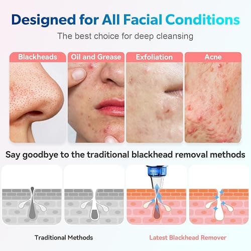 Blackhead Remover Pore Vacuum Upgraded Facial Pore Cleaner Electric Comedone Whitehead Extractor Tool-5 Suction Power,5 Probes,USB Rechargeable thumbnail 4