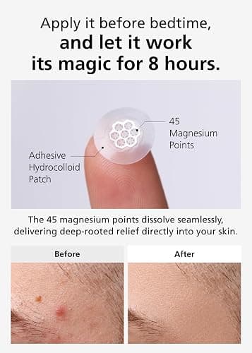 DWEasyDerm Quick Calming Magnesium Patches(20 patches) with Cica Ampoule - Intensive Care, Pimple patches, Hydrocolloid Band, Zits Spot care Overnight Home Care 2-8 hours, New boxs types thumbnail 5