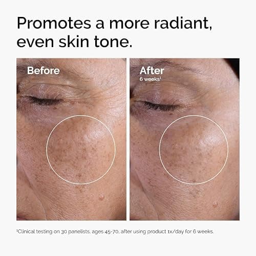 The Ordinary Glycolic Acid 7% Exfoliating Toner, Brightening and Smoothing Daily Toner for More Even-Looking Skin Tone thumbnail 2
