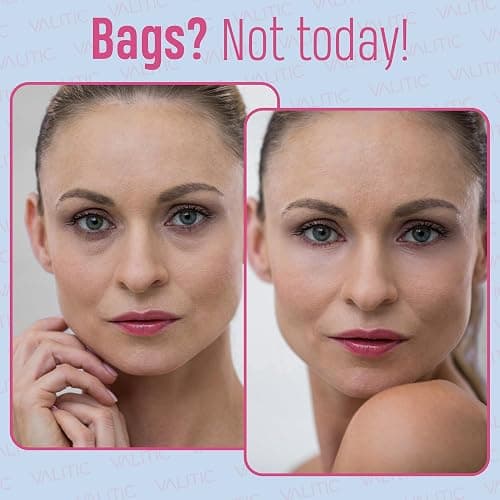 VALITIC Kojic Acid Under Eye Masks - Brightening Under Eye Patches Travel Essentials for Women and Men - Fades Dark Circles and Reduces Puffy Eyes - with Niacinamide, Collagen and Caffeine - 6 Pack thumbnail 3