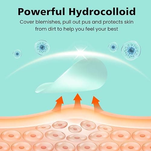 Dr.patch 563 Count Pimple Patches, Acne Patches for Face & Body | Hydrocolloid Patches, Invisible Thin, Large & Small Sizes for Whiteheads, Zits & Breakouts (Dots, Strip, Contoured 6 Sizes) thumbnail 8