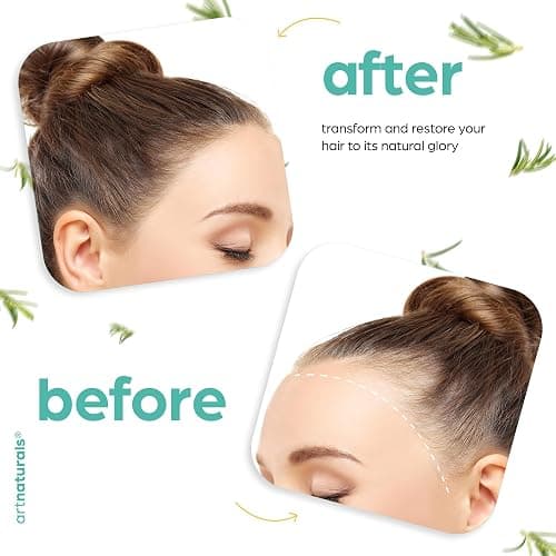 ArtNaturals Organic Rosemary & Castor Hair Growth Oil + Scalp Massager Set – Hair Relaxer for Dry, Itchy Scalp, Thickening & Hydration - Scalp Oil Products For Damaged Hair & Split Ends – 4.0 oz thumbnail 6