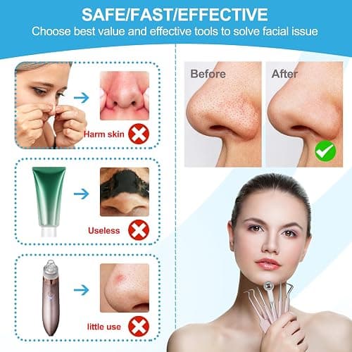 Pimple Popper Tool Kit Blackhead Remover Tools (5 Piece Kit), Professional Stainless Black Head Remover for face, Risk Free Treatment Pimple Extractor with Tweezers thumbnail 2