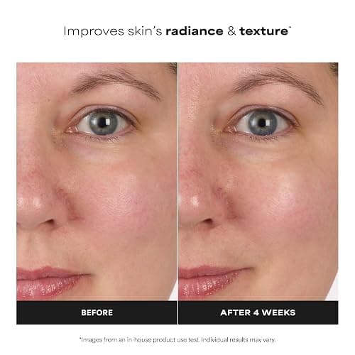 Paula's Choice SKIN BALANCING Pore-Reducing Face Toner with Niacinamide, for Oily Skin & Combination, Minimizes Large Pores, Controls Oil & Shine, Hydrates & Replenishes, Fragrance-Free thumbnail 4