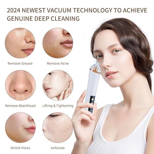 Blackhead Remover Pore Vacuum,Facial Pore Cleaner-6 Suction Power,3 Adjustable Suction Levels,USB Rechargeable Blackhead Vacuum Kit Electric Acne Extractor Tool for Women & Men (White) thumbnail 2