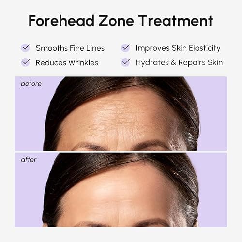 MAREE Forehead Wrinkle Patches – Collagen Wrinkle Patches with Retinol & Hyaluronic Acid for Face Lift – Fine Lines Deep Forehead Wrinkles Treatment Remover – Face Tape for Wrinkles Between Eyebrows thumbnail 3