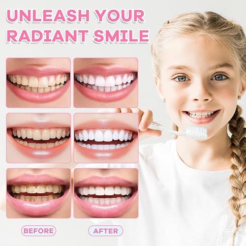 Niacinamide Whitening Toothpaste, Niacinamide Toothpaste Intensive Whitens Teeth, Protects Tooth Enamel, Fresh Breath & Stain Removal Formula,Freshens Breath 24 Hours (Mint). - Mint - 3.5 Fl Oz (Pack of 1) thumbnail 6