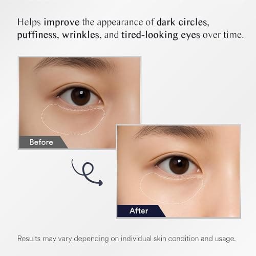 Under Eye Patches for Puffiness and Bags: Eye Mask for Puffy Eyes and Dark Circles Treatment with Collagen Hyaluronic acid - Women Cooling Gel Pads for Brightening Hydrating Anti-Wrinkles 30 Pairs thumbnail 3