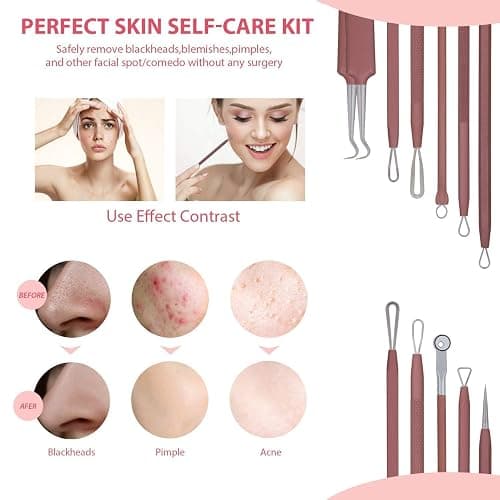 JPNK Blackhead Remover Tool Comedones Extractor Acne Removal Kit for Blemish, Whitehead Popping, 6 Pcs Zit Removing for Nose Face Tools with a Leather Bag (Pink) thumbnail 2