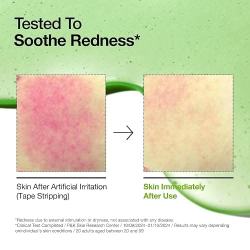 Anua Azelaic Acid 10 Hyaluron Redness Soothing Serum, Facial Serum for Sensitive skin, Hyaluronic Acid, Niacinamide, Spot Care, Natural Color, Vegan, Korean Skincare (30ml/ 1.01 fl oz.) thumbnail 3