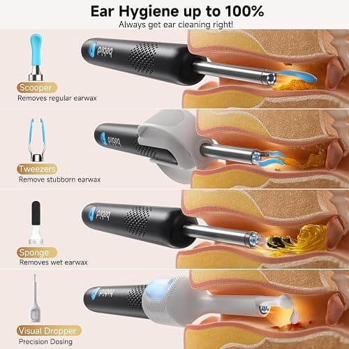 BEBIRD R1 Ultra Ear Wax Removal, Ear Cleaner with Camera Ear Scope, Wax Remove Ear Pick with Ear Otoscope Tweezers, Visual Dropper Cleaning Kit, Ear/Nose/Throat Examination Tool for Family thumbnail 4
