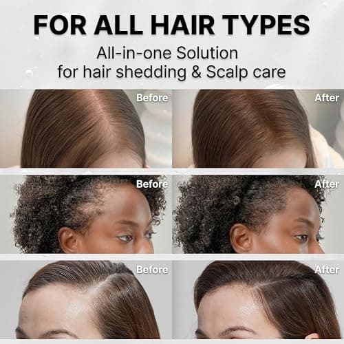 lilyeve GROWTURN Hair Growth Serum with Built-in Brush, Heartleaf-Derived Exosomes to Revitalize Hair, Hair Thickening, Hair Growth Accelerator - Korean Hair Care, 3.38 fl. oz. (Pack of 1) thumbnail 6