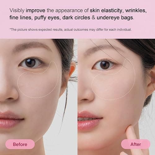TEREZ & HONOR Peptide Collagen Under Eye Patches - 60 Korean Firming, Glowing & Hydrating Hydrogel Mask for Puffy Eyes, Dark Circles, Wrinkles, Fine Lines, Undereye Bags - Anti-Aging Eye Gel Pads thumbnail 4