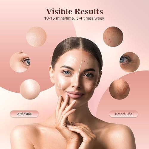 INTEO Red Light Therapy for Face, 3 Modes Portable Led Face Mask Light Therapy with Remote, Infrared Light Mask with Timing Function, Led Light Therapy At Home, Pink thumbnail 3