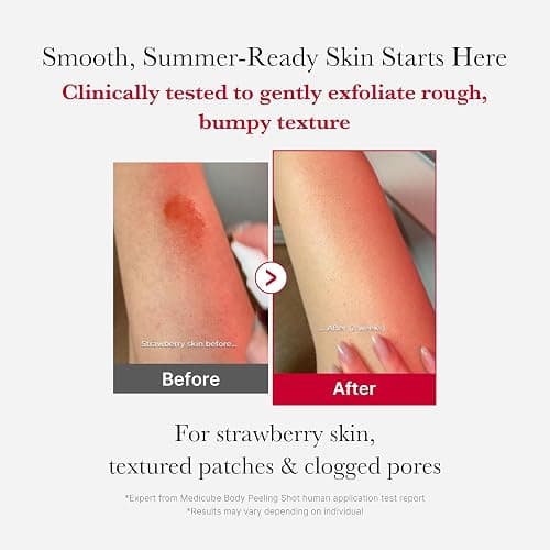 medicube Red Body Peeling Shot, AHA + BHA Exfoliating Body Spray for Summer-Ready Smooth Skin, Treats Strawberry Skin, Bumps & Breakouts, 3.88 oz thumbnail 2