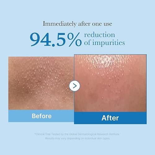 medicube Cleansing Oil Zero Pore Blackhead | Makeup Remover for all skin types, Daily Moisture Facial Cleanser, Low-Irritation, Korean Skin Care, 205ml / 6.93 fl.oz thumbnail 2