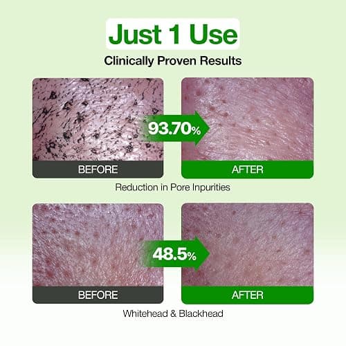 FULLY Green Tomato Pore Clay Mask Cleanser for Deep Cleansing, 4.05 fl oz | Clay Pack Cleanser for Deep Pore Cleansing, Blackhead & Sebum Control, Gentle Korean Face Wash for Oily & Combination Skin thumbnail 4