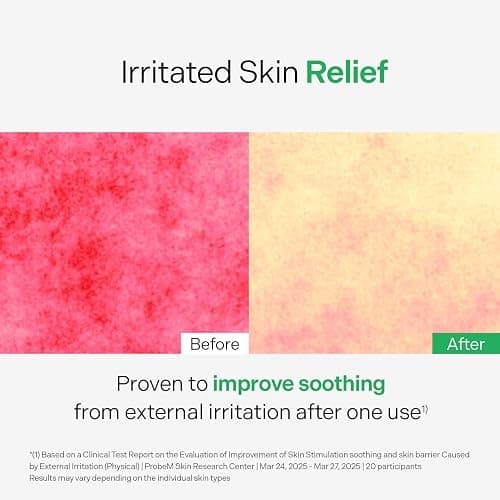 torriden control serum thumbnail 5