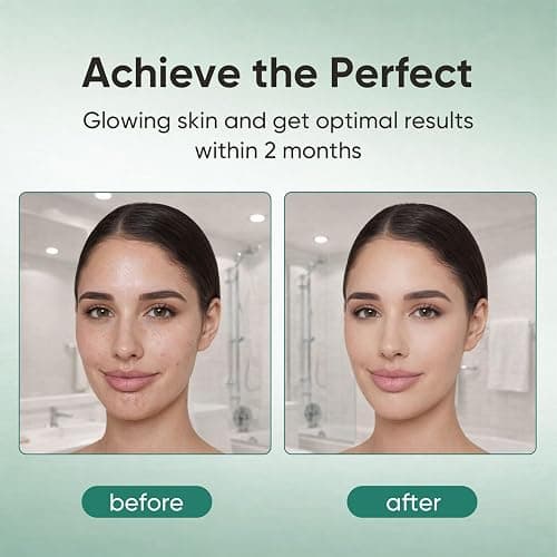 FWPTEI LYSA Acne Gummies, LYSA Ritual Acne Treatment Immune Support & Skin Health - High Potency Vegan Gummies, Sugar-Free, Gluten-Free Gummy Supplement, 60 Gummy thumbnail 4
