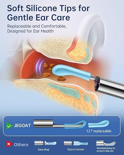 Jegoat Ear Wax Removal, Ear Wax Removal Tool Camera with 1296P HD Camera and 6 LED Lights, Ear Cleaner with 10 Ear Pick, Upgraded Ear Wax Removal Kit for iOS and Android, Black thumbnail 2