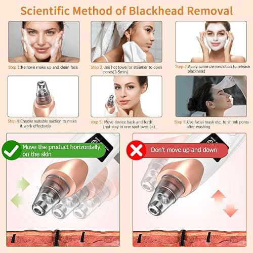 2025 Pore Vacuum, USB Rechargeable Blackhead Remover Vacuum,3 Levels Adjustable Pore Vacuum Blackhead Remover, with 5 Suction Power,6 Probes,Face Vacuum Pore Cleanser for Women & Men-White thumbnail 7