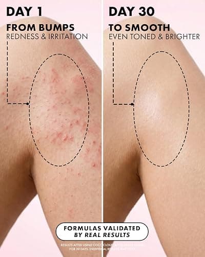 Truly Luxury After Shave Serum | Soothing & Hydrating Post Shave Treatment to Prevent Ingrown Hair For Smooth, Irritation-Free Skin thumbnail 7