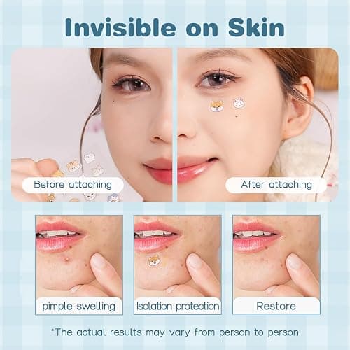 VENROCK Pimple Patches for face,24 Cute Pet Shapes 48 Count Hydrocolloid Acne Treatment for Covering Zits & Blemishes Spot for Kids & Adults, with Salicylic Acid, Tea Tree Oil, Centella Asiatica Oil thumbnail 6