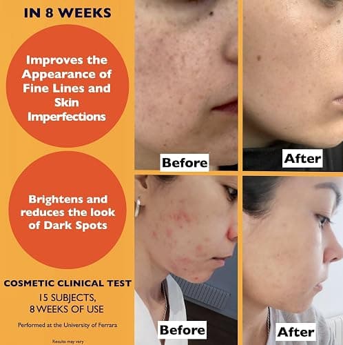 Big 2.11oz. Organic Vitamin C Serum for Face. Anti-Dark Spots, Wrinkles Skin Repair Serum with Hyaluronic Acid, Vitamin C & Niacinamide. All-in-One Brightening, Anti Aging Facial & Eye Area Skincare thumbnail 5