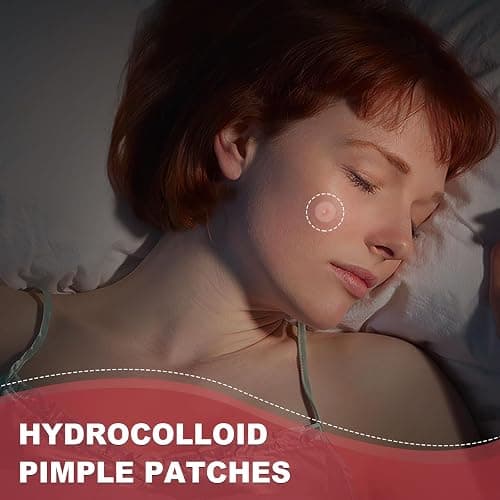 216 Counts Pimple Patches for Face, Hydrocolloid Acne Patches Zit Patches for Face Overnight Care Acne Spot Treatment Patch Cystic Acne Treatment Stickers Blemish Hydrocolloid Cover for all Skin Type thumbnail 7