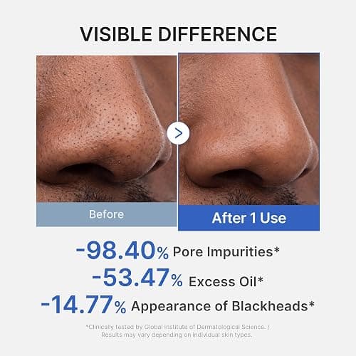 medicube Zero Pore Blackhead Mud Mask - Pore Cleansing & Gentle Exfoliating | Blackhead-Removing Clay Mask with AHA BHA PHA, Pore Minimizing & Cooling Care, 3 Min Quick Dry, Korean Skincare 3.52 oz. thumbnail 4