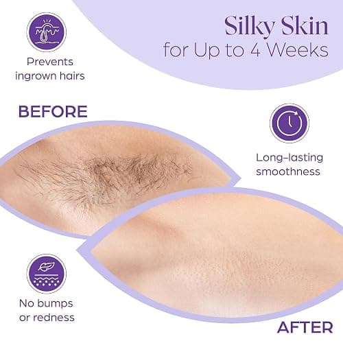 765 Professional Wax Strips for Waxing – Tear-Resistant Fabric Hair Removal Strips – 225 Large & 540 Small – Reusable for Warm Wax & Sugar Paste – Face, Body & Intimate Areas thumbnail 6