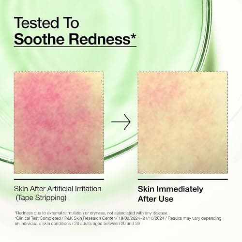 Anua Serum <3 thumbnail 5