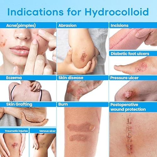 WIFAMY Hydrocolloid Roll for Wound Care: Extra Large 2IN*16.4FT Medical Grade Hydrocolloid Bandages with Self-Adhesive Cut-to-Size Pimple Patch Roll Ultra Absorbent Waterproof First Aid Kit Essential thumbnail 4