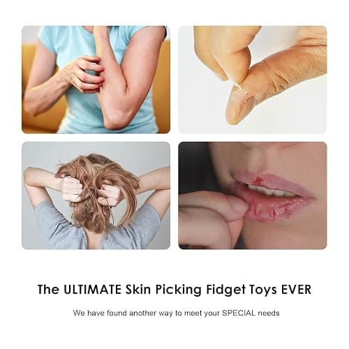 Pick Stone for Anxiety Relief, Pick Peel Calming Stone, Reduce Stress Fidget Picky Stone kit with Display Stand for Dermatillomania, ADHD, OCD thumbnail 4